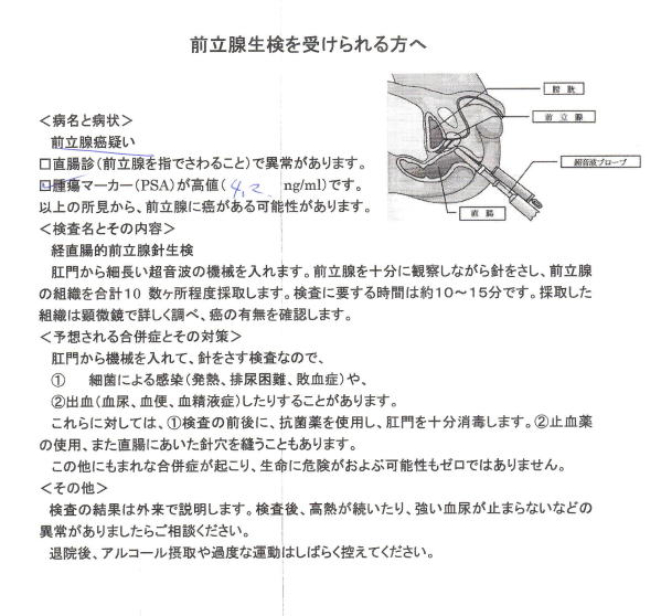 前立腺生検